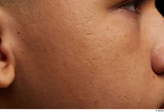 HD Face Skin Cary Stanley cheek face skin pores skin…